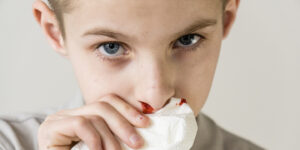 Nose Bleeding