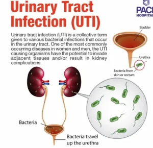 Urinary Tract Infection