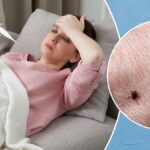 Scrub Typhus: Causes, Symptoms, and Treatment Explained